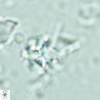Nannoturba joceliniorum VR 02477