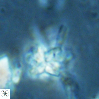 Nannoturba joceliniorum VR 02483