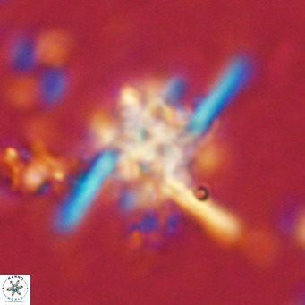 Nannoturba joceliniorum VR 02573