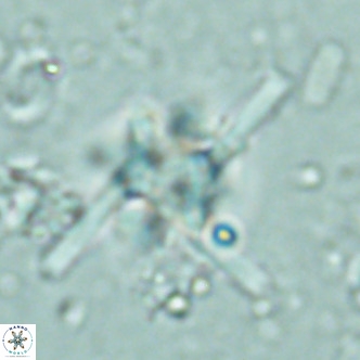 Nannoturba joceliniorum VR 02576