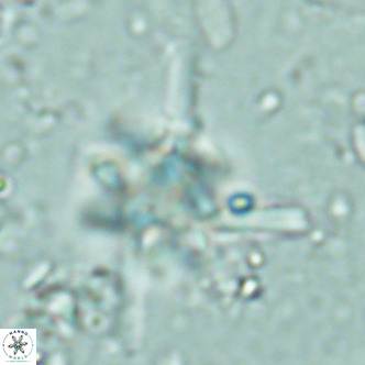 Nannoturba joceliniorum VR 02579