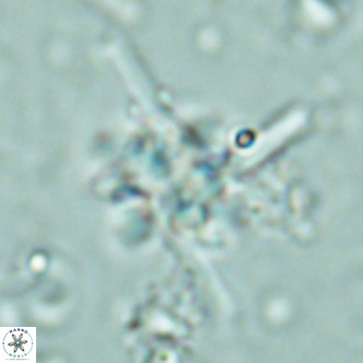 Nannoturba joceliniorum VR 02580