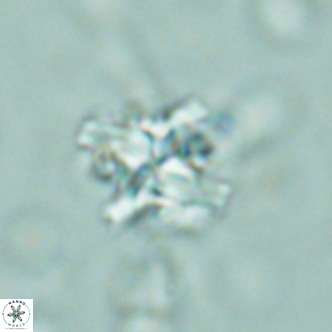 Nannoturba joceliniorum VR 02581