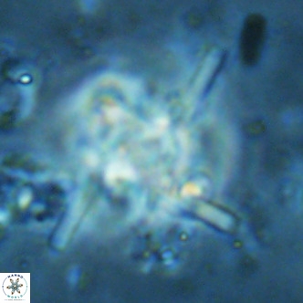 Nannoturba joceliniorum VR 02582