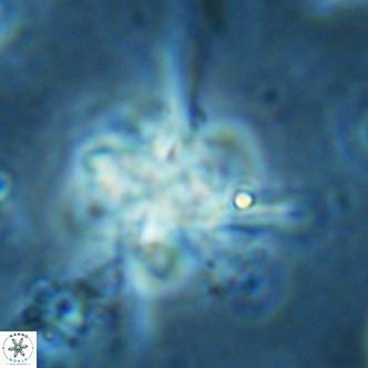 Nannoturba joceliniorum VR 02584