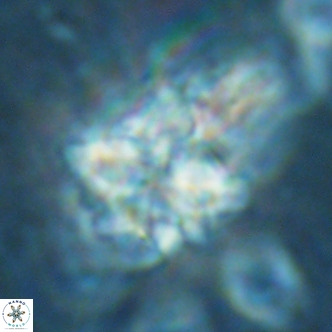 Nannoturba robusta VR 02417