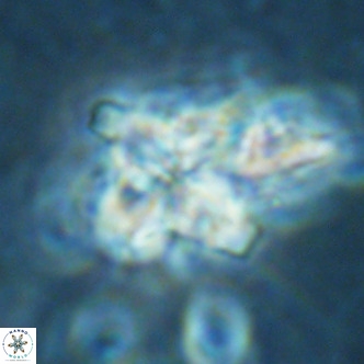 Nannoturba robusta VR 02418