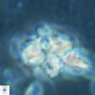 Nannoturba robusta VR 02419