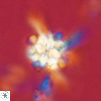 Nannoturba robusta VR 02570