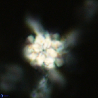 Nannoturba robusta VR 02571