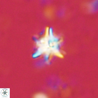Nannoturba spinosa VR 02435