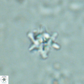 Nannoturba spinosa VR 02439
