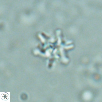 Nannoturba spinosa VR 02440