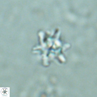 Nannoturba spinosa VR 02441