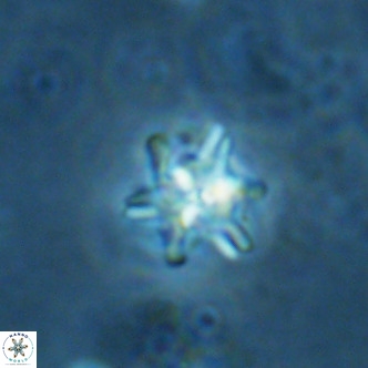 Nannoturba spinosa VR 02442