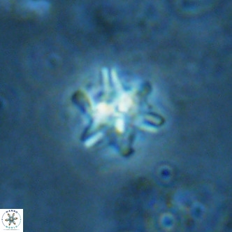Nannoturba spinosa VR 02443