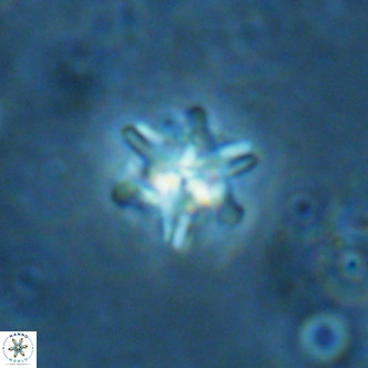 Nannoturba spinosa VR 02444