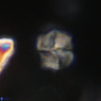 Nannotetrina tetrasepta VR 31061