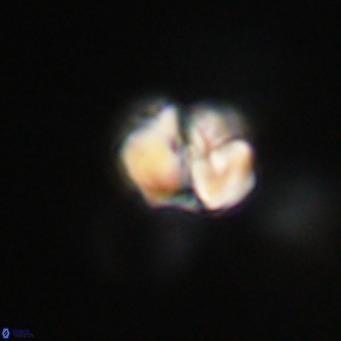 Nannotetrina tetrasepta VR 31022