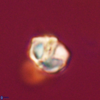 Nannotetrina tetrasepta VR 31026