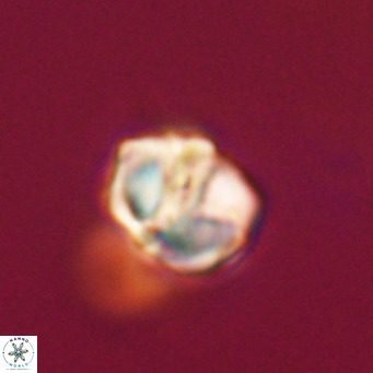 Nannotetrina tetrasepta VR 31026