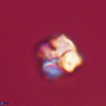 Nannotetrina tetrasepta VR 31027