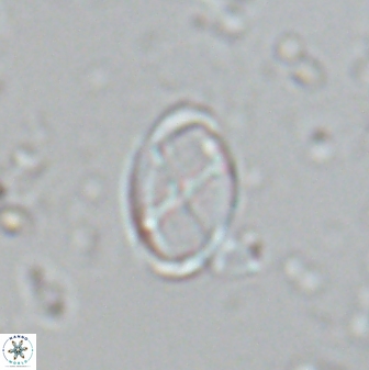 Neochiastozygus gammation 24694
