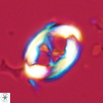 Neochiastozygus distentus 20167