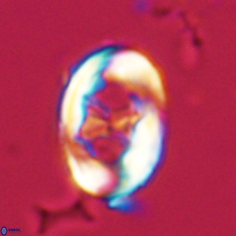 Neochiastozygus distentus 20169
