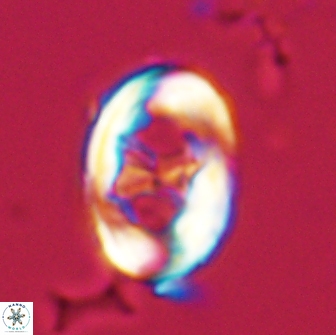 Neochiastozygus distentus 20169
