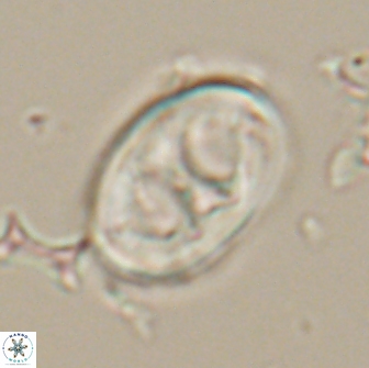 Neochiastozygus distentus 20173