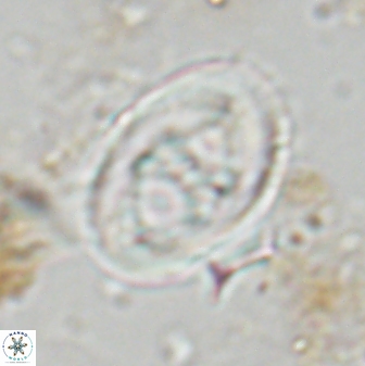 Neochiastozygus distentus 23316