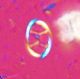 Neochiastozygus kallanxhiae 24896