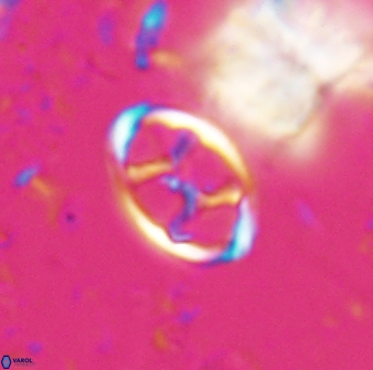 Neochiastozygus kallanxhiae 24899