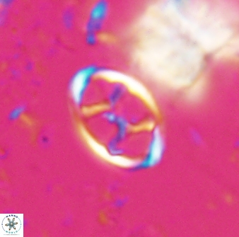 Neochiastozygus kallanxhiae 24899