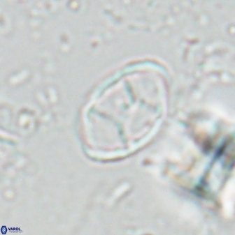 Neochiastozygus kallanxhiae 24900