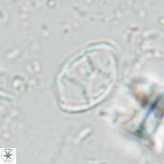 Neochiastozygus kallanxhiae 24900