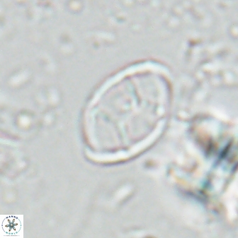 Neochiastozygus kallanxhiae 24901