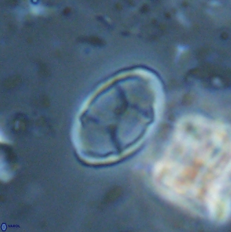 Neochiastozygus kallanxhiae 24902