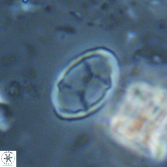 Neochiastozygus kallanxhiae 24902