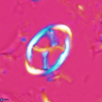 Neochiastozygus kallanxhiae 25637