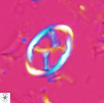 Neochiastozygus kallanxhiae 25637