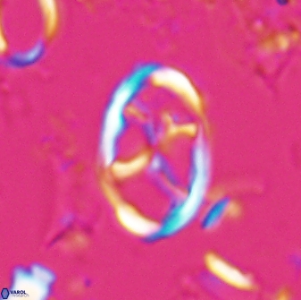 Neochiastozygus kallanxhiae 25640