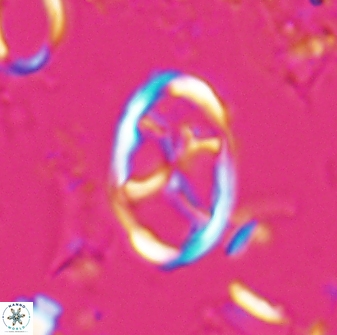 Neochiastozygus kallanxhiae 25640