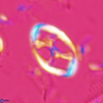 Neochiastozygus kallanxhiae 25641