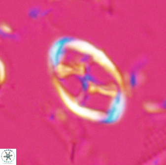 Neochiastozygus kallanxhiae 25641