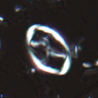 Neochiastozygus kallanxhiae 25642