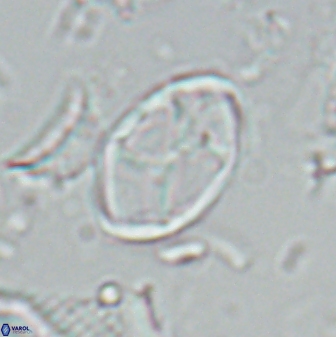 Neochiastozygus kallanxhiae 25643