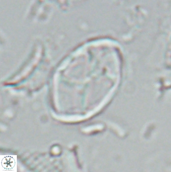 Neochiastozygus kallanxhiae 25643