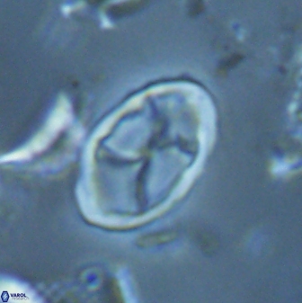 Neochiastozygus kallanxhiae 25644